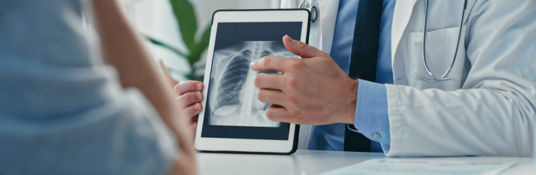 Understanding Lung Cancer with Dr. Jay Hendler: A Physician’s Perspective on Risk, Screening and Prevention 